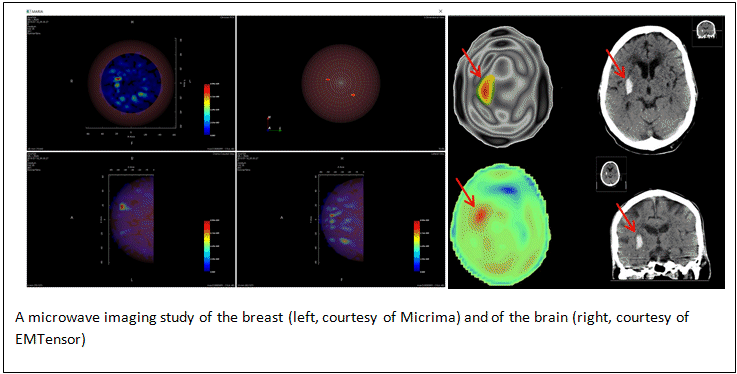 microwave case studies